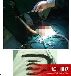 国产黄鳝视频下载,热门内容背后的秘密  第2张